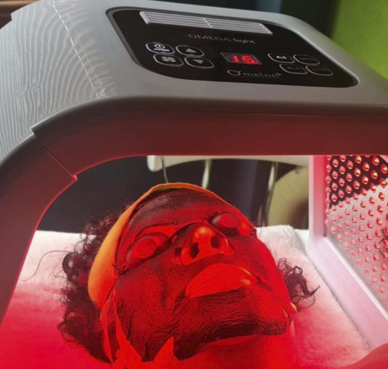 fototerapia2